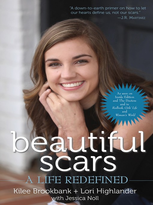 Title details for Beautiful Scars by Kilee Brookbank - Available
